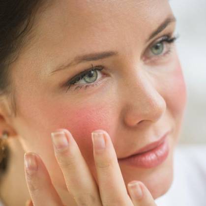 For Rosacea og cuperose