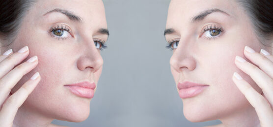 Hudpleie for sensitiv hud