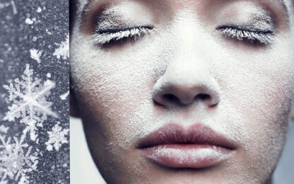 hudpleie av vinterhuden