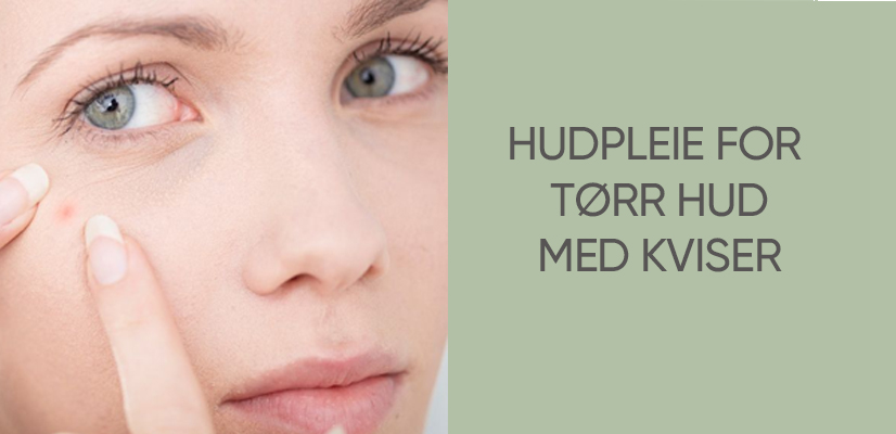 Tørr hud med kviser