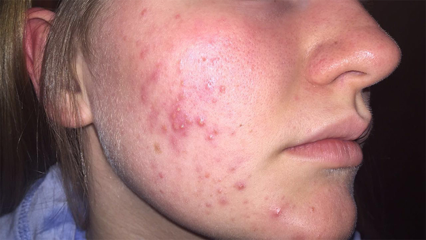 Kaja før hun prøvde Mario Badescu