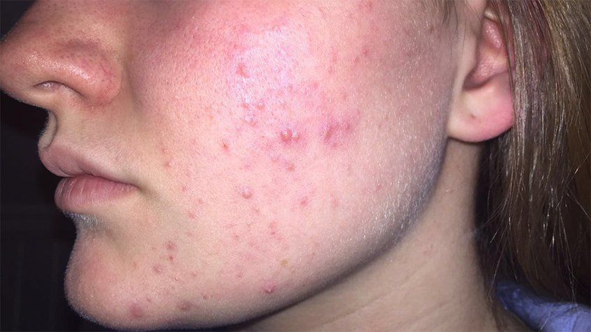 Kaja før hun prøvde Mario Badescu