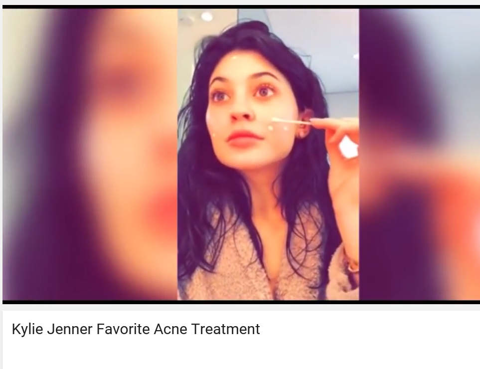 Kylie Jenner og drying Lotion - karma.no