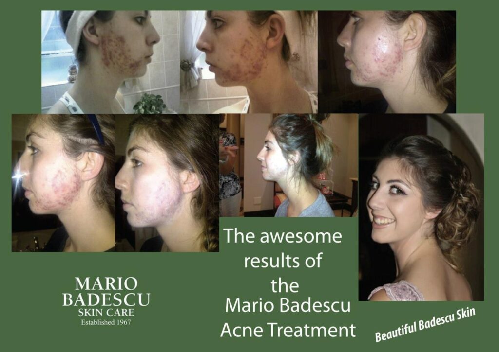 Det er resultatene som teller