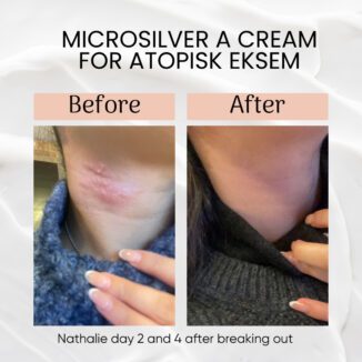 wooden spoon microsilver a cream for atopisk eksem