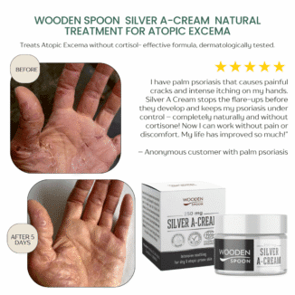 Wooden Spoon Microsilver A Cream for atopisk eksem. effektiv behandling