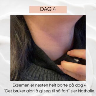 wooden spoon microsilver a cream for atopisk eksem