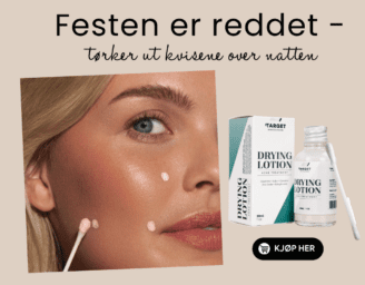 bli kvitt kvisene over natten med target skin solution drying lotion