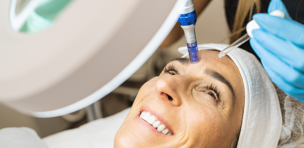 Microneedling kan hjelpe på kollagenproduksjonen i huden